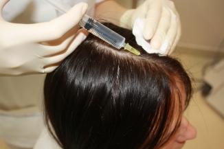 Mesotherapy